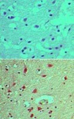 Immunohistochemistry-Paraffin: SHIP2/INPPL1 [p Tyr497] Antibody [NBP2-24461]